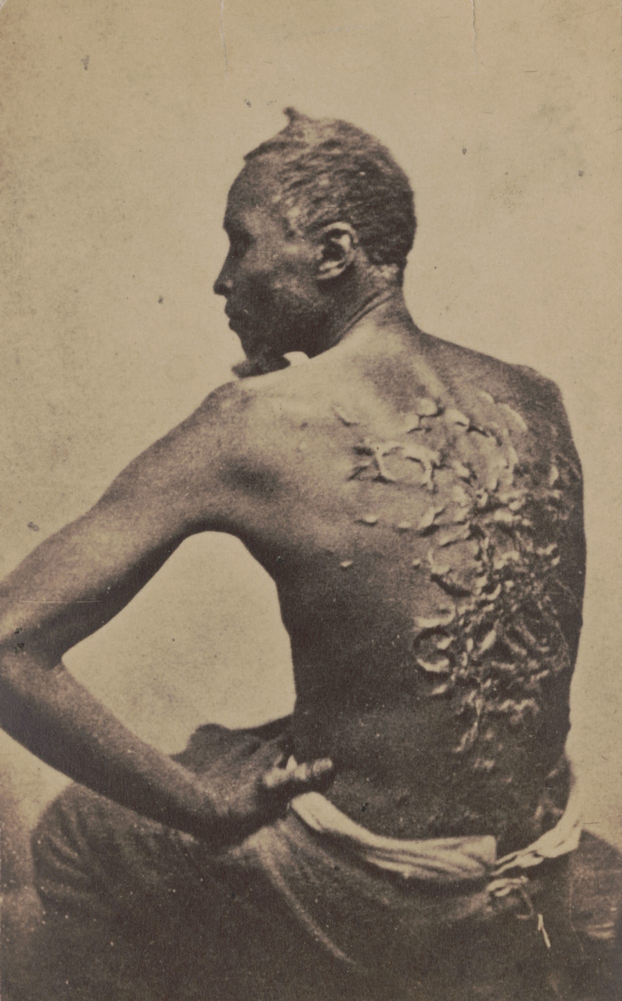 Picture of slave with whip scars